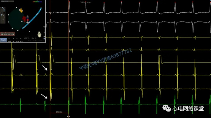 发动机心电图官方下载及男友激活码,深层设计解析策略-kit_v5.385